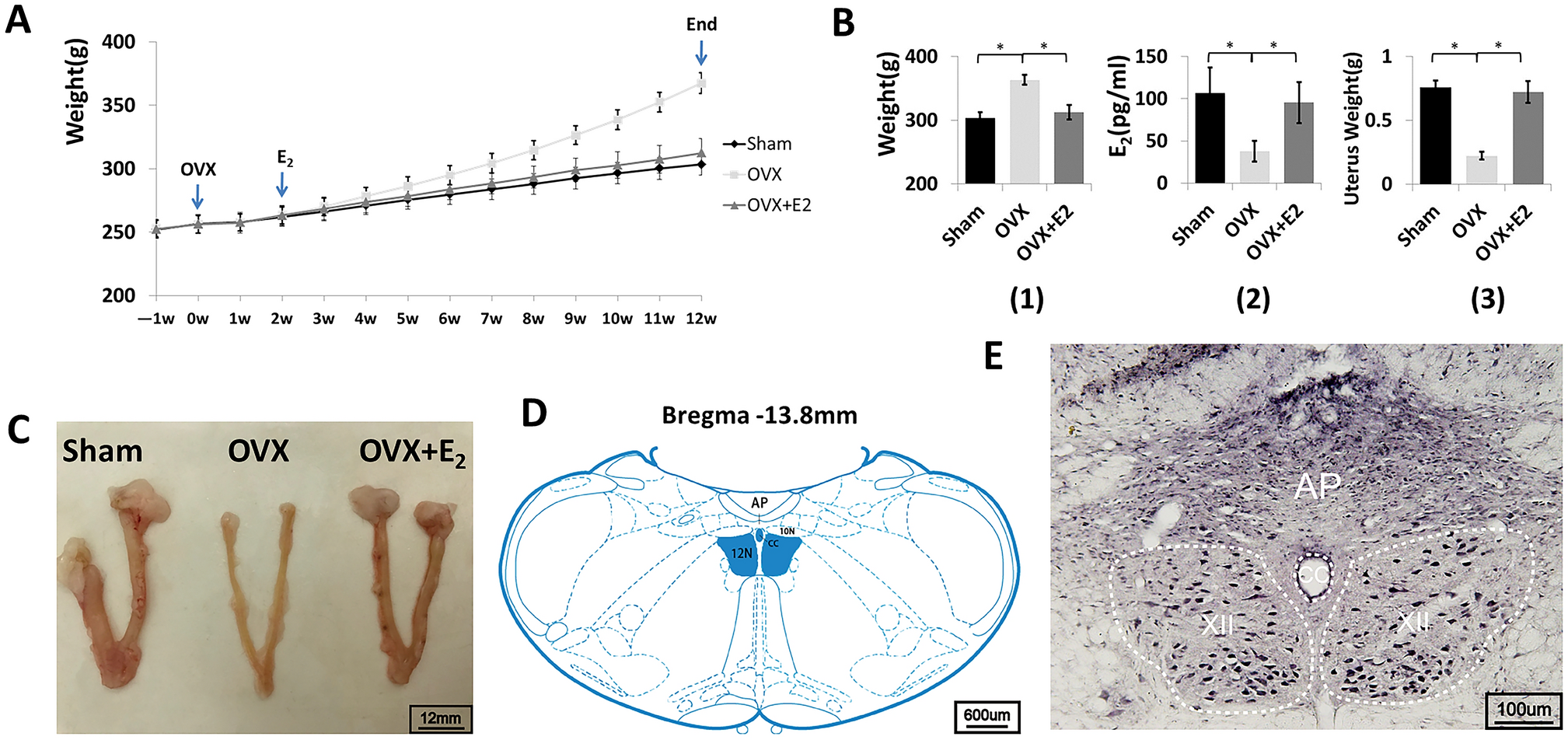 Impact of ovariectomy on neurotransmitter receptors BDNF/TrkB and endoplasmic reticulum molecular chaperones in rat hypoglossal nucleus