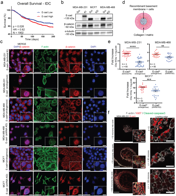 E-cadherin interacts with EGFR resulting in hyper-activation of ERK in multiple models of breast cancer