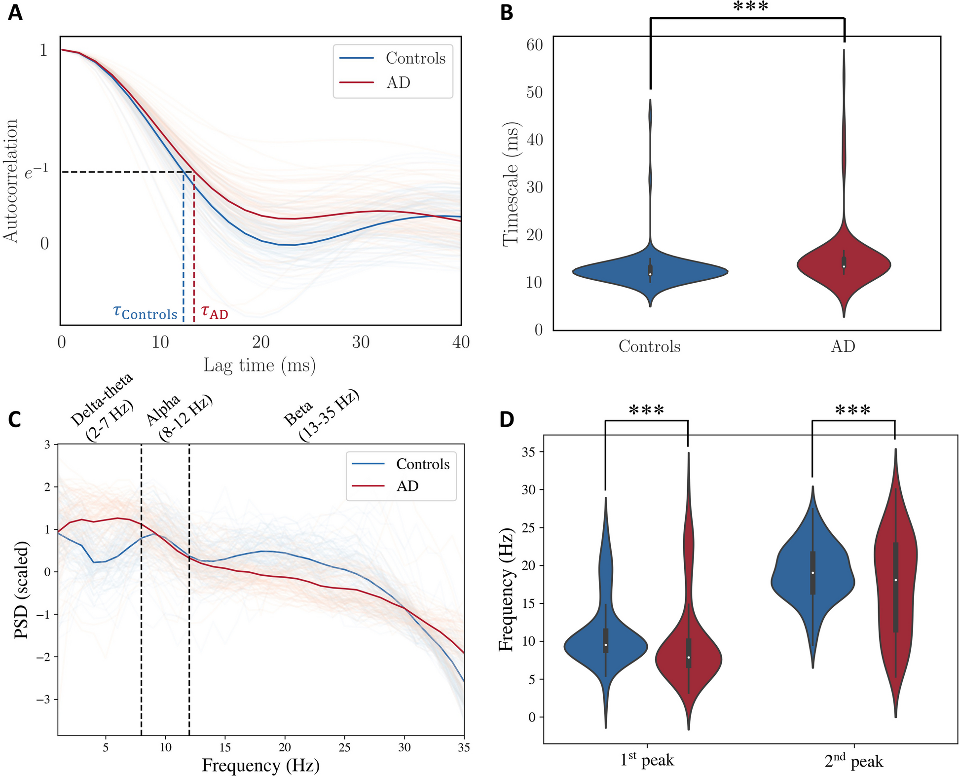 Impaired long-range excitatory time scale predicts abnormal neural oscillations and cognitive deficits in Alzheimer’s disease