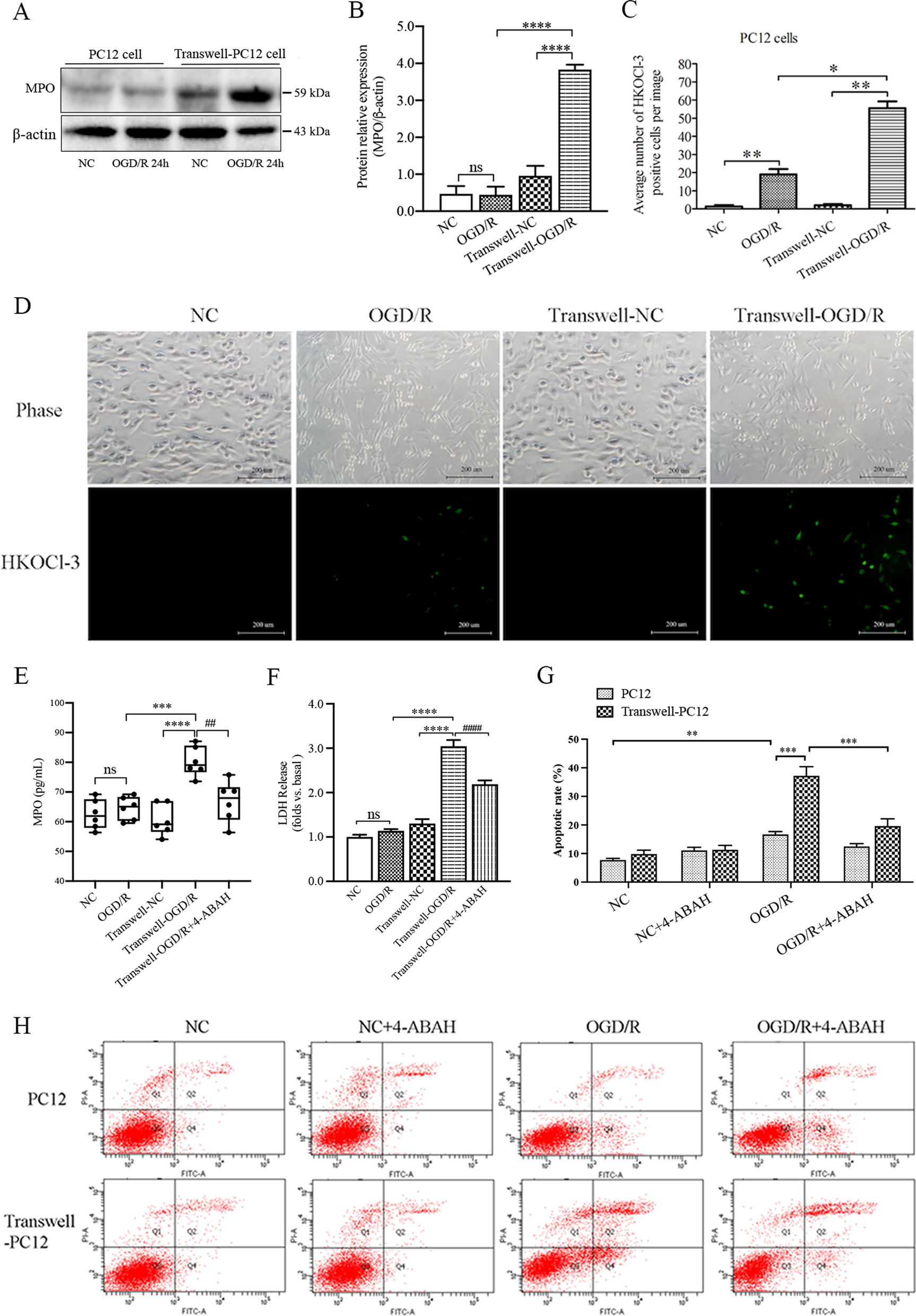 Hypochlorous acid derived from microglial myeloperoxidase could mediate high-mobility group box 1 release from neurons to amplify brain damage in cerebral ischemia–reperfusion injury