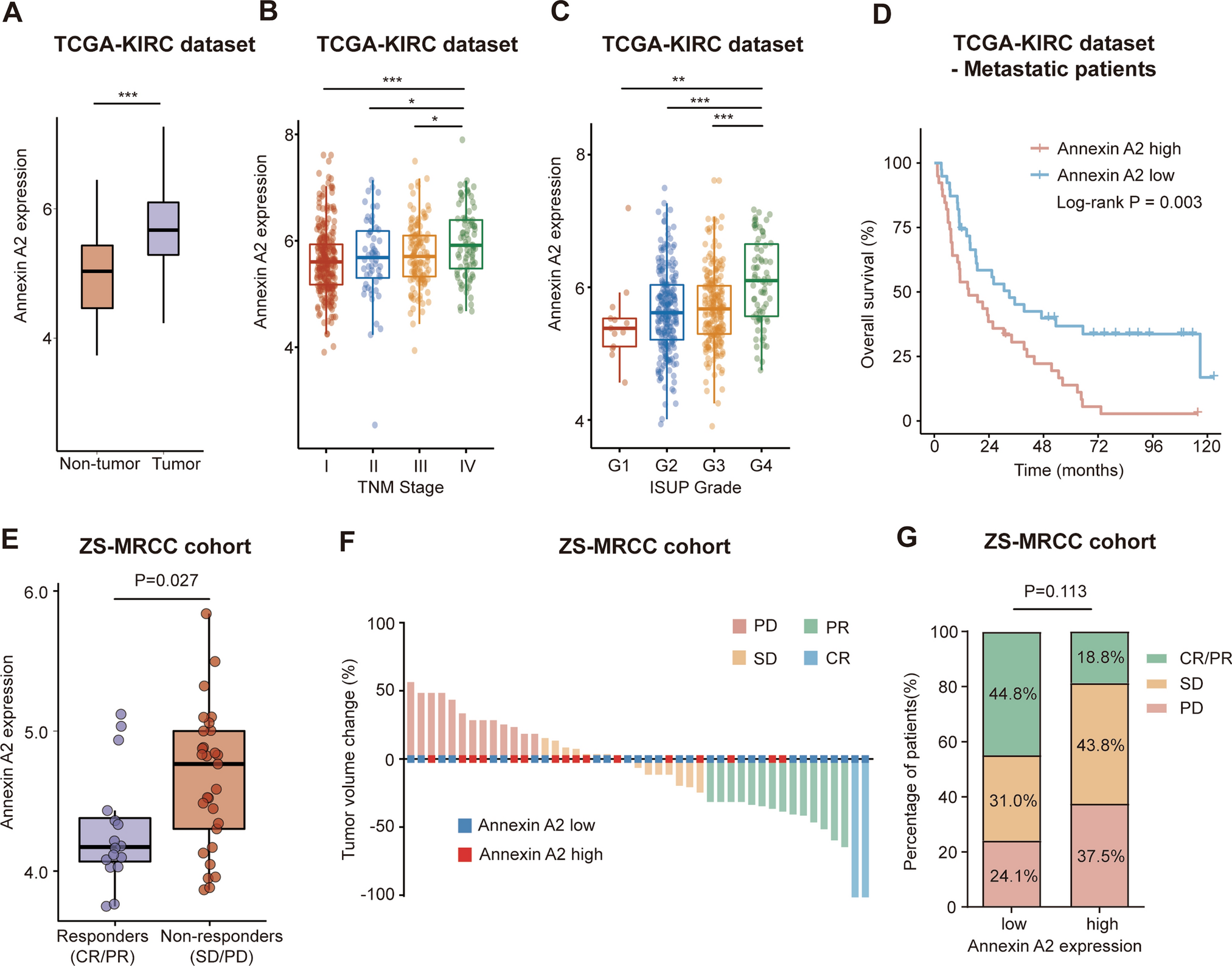 Effect of Annexin A2 on prognosis and sensitivity to immune checkpoint plus tyrosine kinase inhibition in metastatic renal cell carcinoma