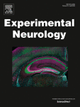 Early developmental changes in a rat model of malformations of cortical development: Abnormal neuronal migration and altered response to NMDA-induced excitotoxic injury