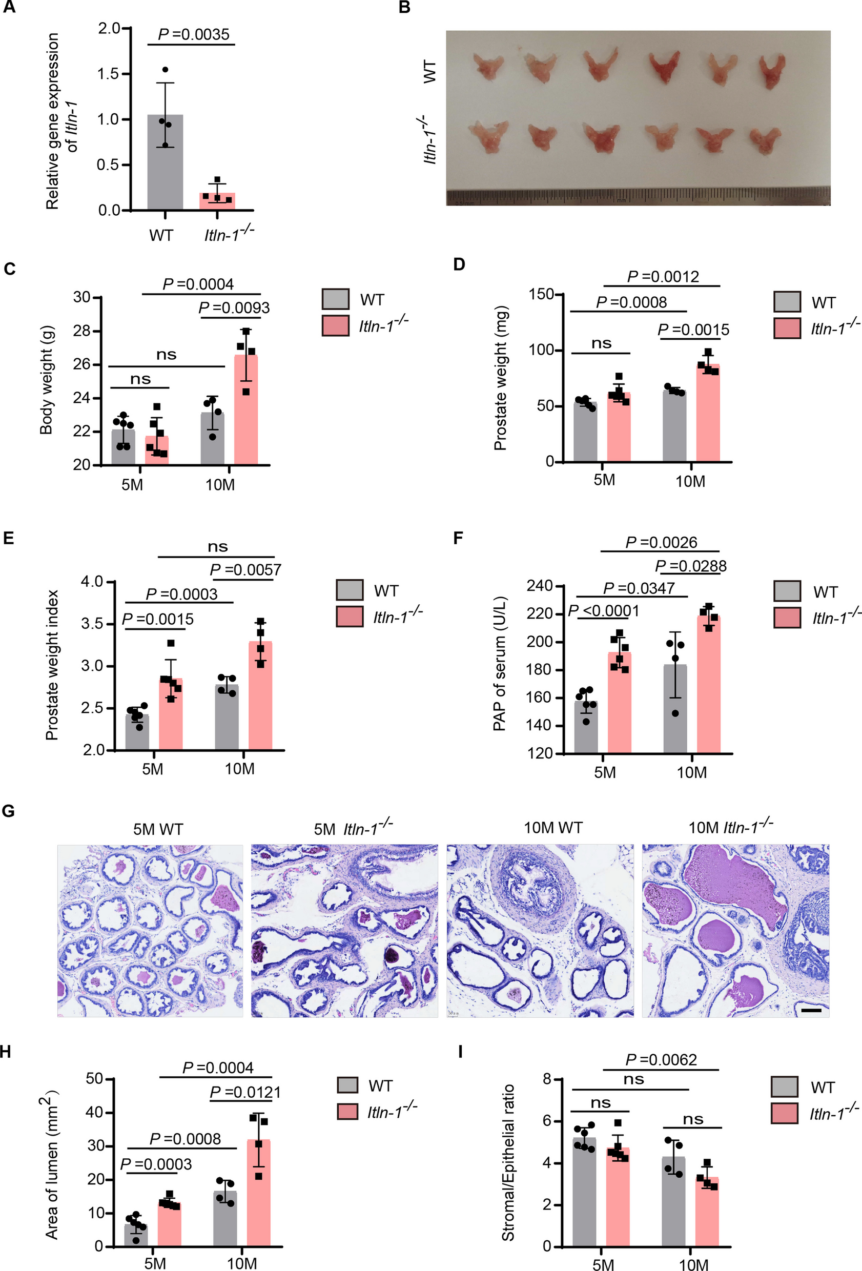 Omentin-1 inhibits the development of benign prostatic hyperplasia by attenuating local inflammation