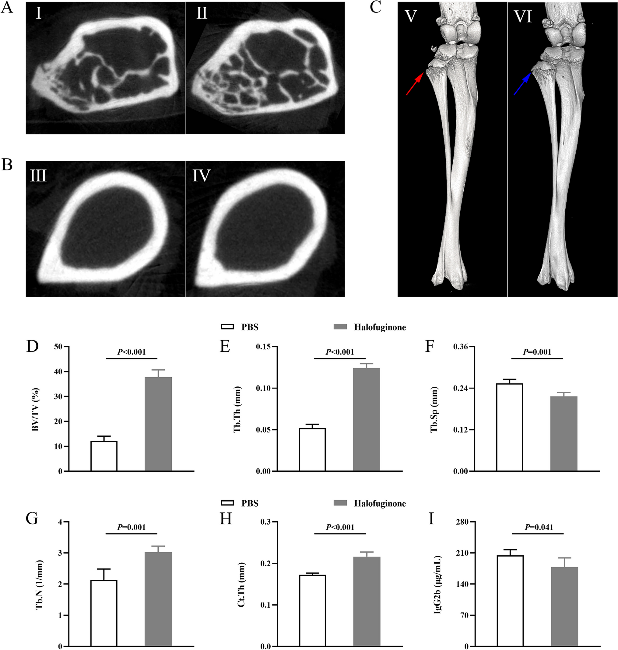 Halofuginone Inhibits Osteoclastogenesis and Enhances Osteoblastogenesis by Regulating Th17/Treg Cell Balance in Multiple Myeloma Mice with Bone Lesions