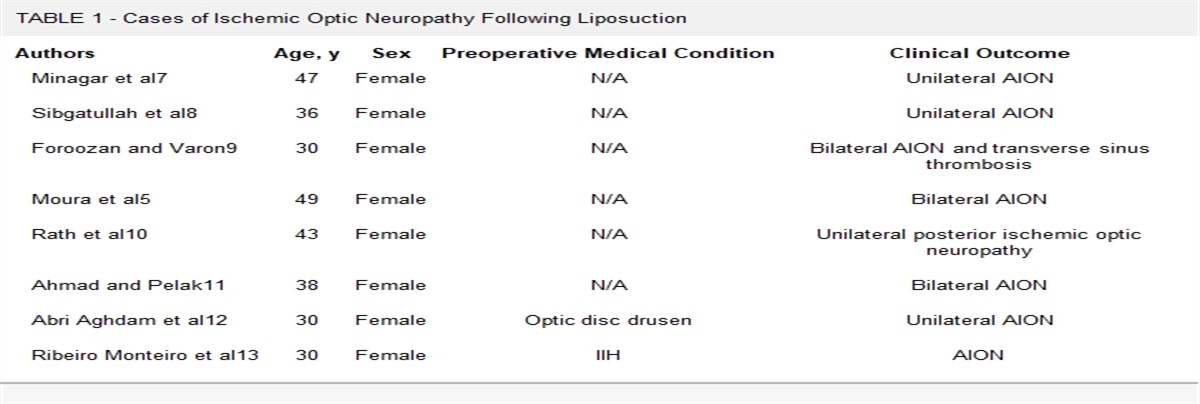 Delayed-Onset Idiopathic Intracranial Hypertension After Liposuction: A Case Report and Review
