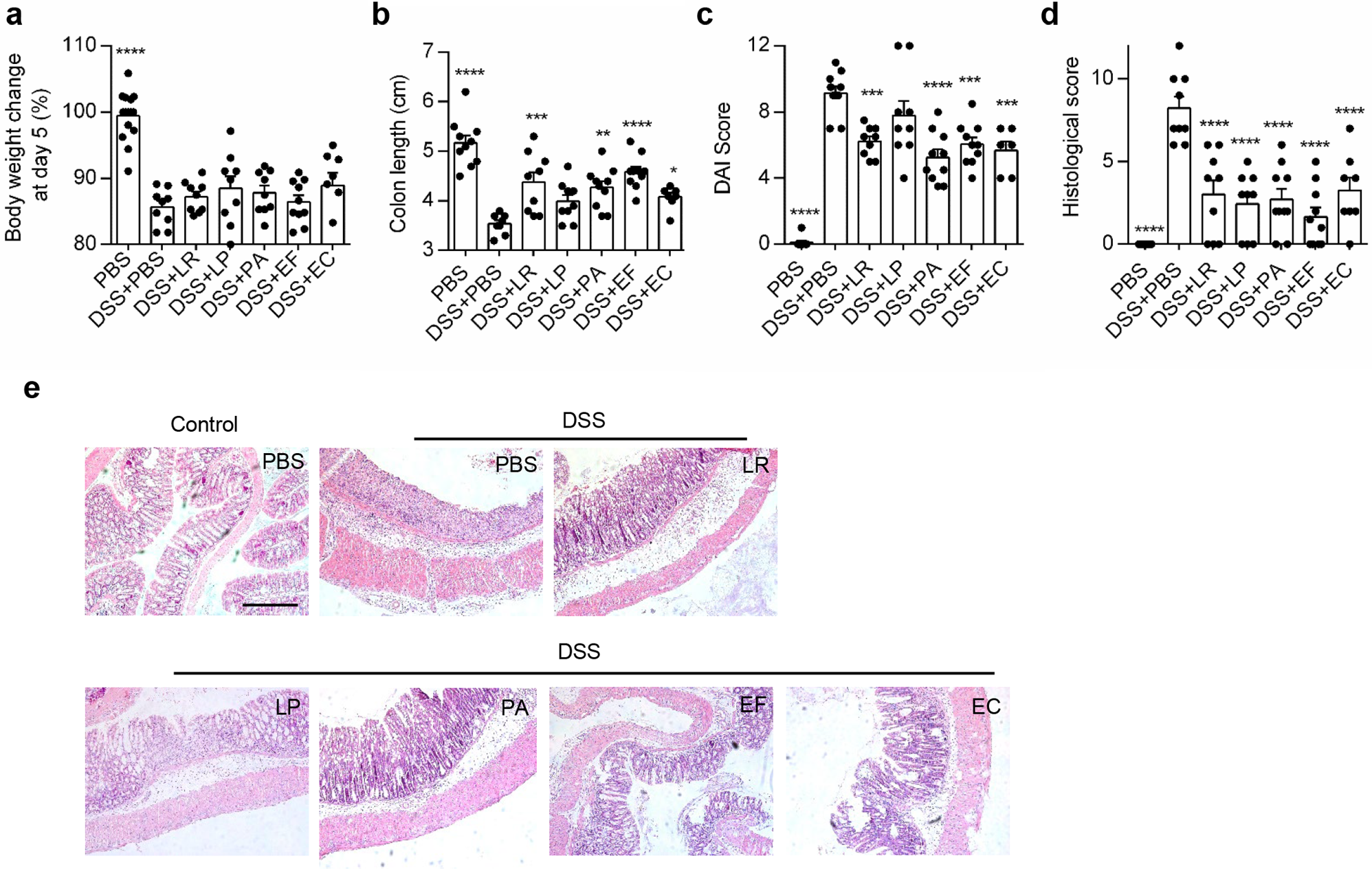 Human-derived bacterial strains mitigate colitis via modulating gut microbiota and repairing intestinal barrier function in mice