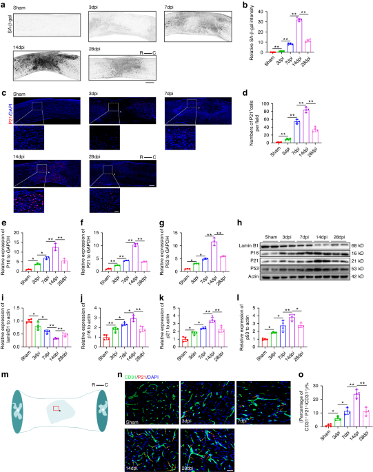 Kdm6a-CNN1 axis orchestrates epigenetic control of trauma-induced spinal cord microvascular endothelial cell senescence to balance neuroinflammation for improved neurological repair