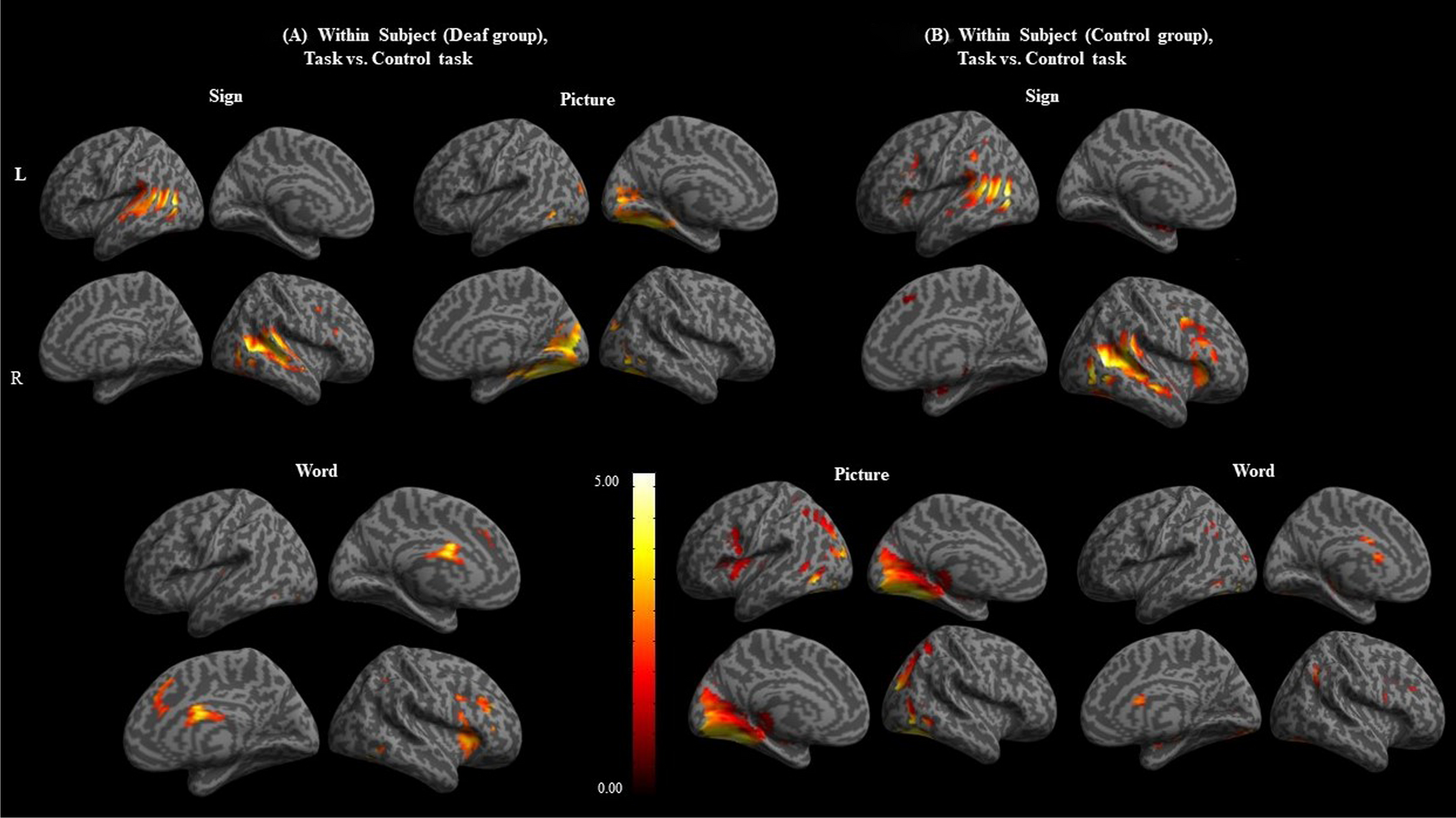 Mapping the unique neural engagement in deaf individuals during picture, word, and sign language processing: fMRI study