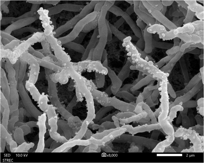 Actinomycetospora termitidis sp. nov., an insect-derived actinomycete isolated from termite (Odontotermes formosanus)