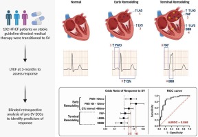 Electrocardiographic predictors of response to sacubitril/valsartan therapy in heart failure with reduced ejection fraction