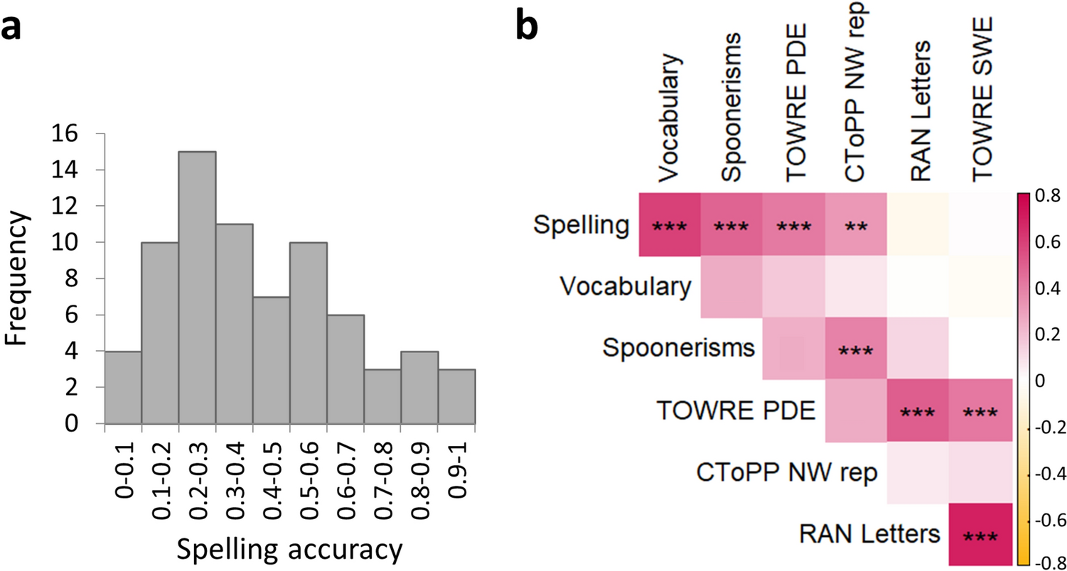 White matter associations with spelling performance
