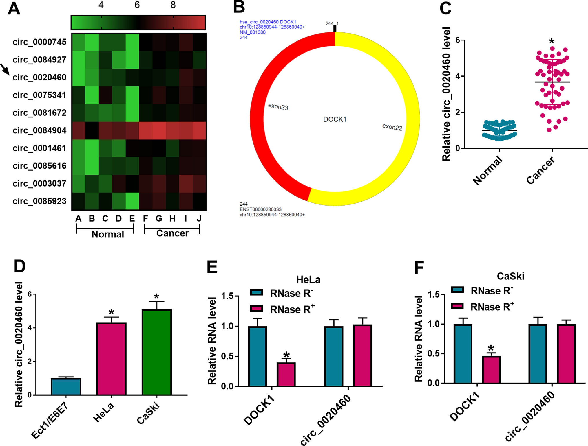 Circ_0020460 drives tumorigenesis in cervical cancer through miR-485-3p sponging