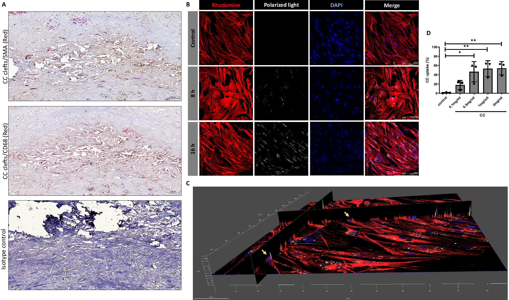 Vascular smooth muscle cells in response to cholesterol crystals modulates inflammatory cytokines release and promotes neutrophil extracellular trap formation