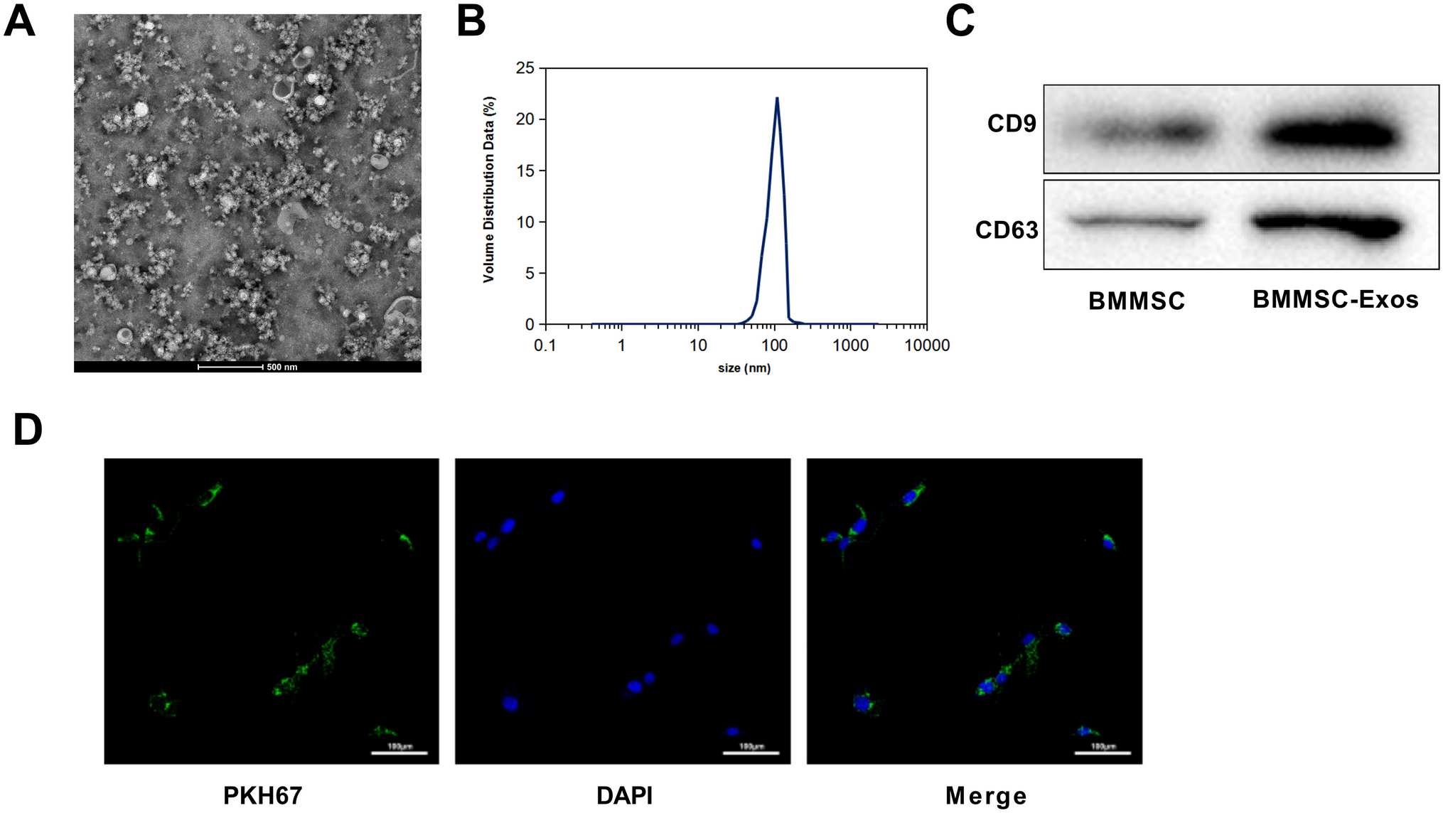 Bone Marrow Mesenchymal Stem Cell-Derived Exosomes Promote the Recovery of Spinal Cord Injury and Inhibit Ferroptosis by Inactivating IL-17 Pathway
