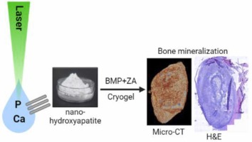 Laser-assisted synthesis of nano-hydroxyapatite and functionalization with bone active molecules for bone regeneration