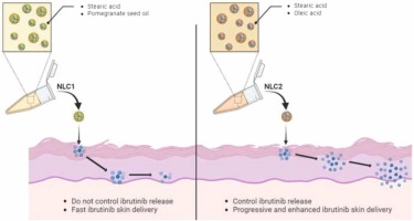 Ibrutinib topical delivery for melanoma treatment: The effect of nanostructured lipid carriers’ composition on the controlled drug skin deposition