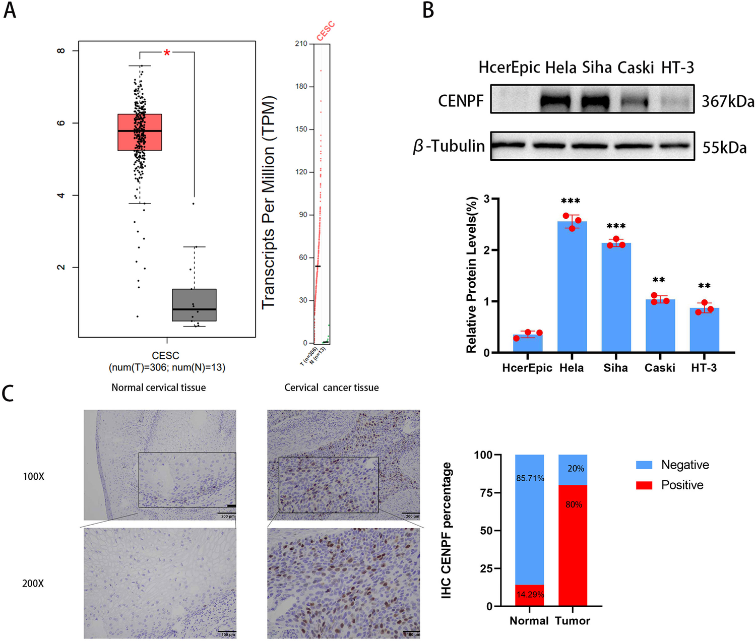 Cell-Cycle-related Protein Centromere Protein F Deficiency Inhibits Cervical Cancer Cell Growth by Inducing Ferroptosis Via Nrf2 Inactivation