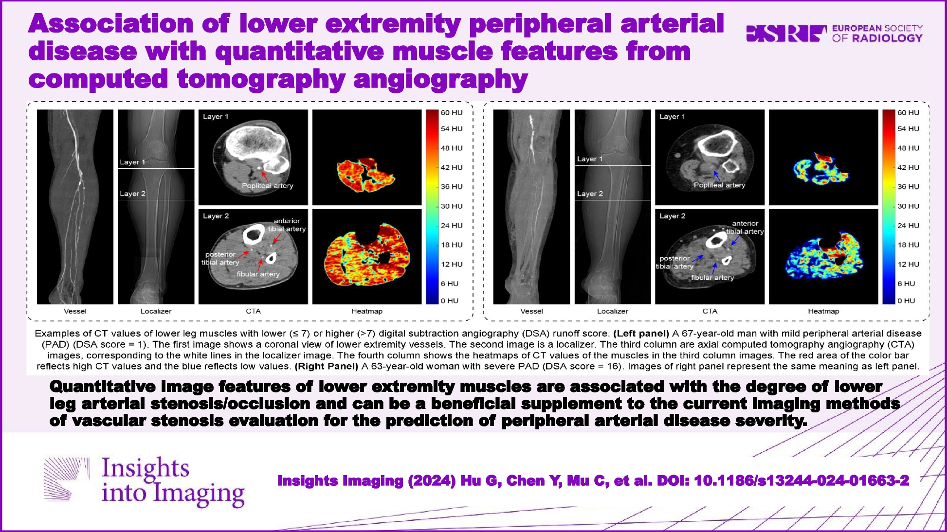 Association of lower extremity peripheral arterial disease with quantitative muscle features from computed tomography angiography