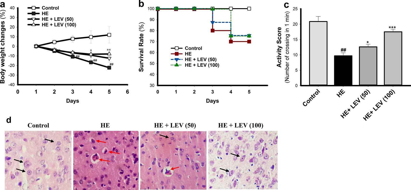 Therapeutic Effect of Levetiracetam Against Thioacetamide-Induced Hepatic Encephalopathy Through Inhibition of Oxidative Stress and Downregulation of NF-κB, NLRP3, iNOS/NO, Pro-Inflammatory Cytokines and Apoptosis