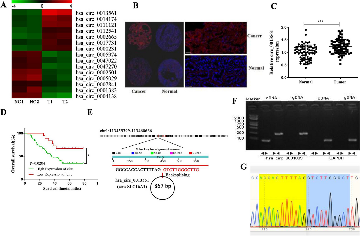 Oncogenic circ-SLC16A1 promotes progression of non-small cell lung cancer via regulation of the miR-1287-5p/profilin 2 axis