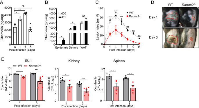 The chemerin-CMKLR1 axis in keratinocytes impairs innate host defense against cutaneous Staphylococcus aureus infection