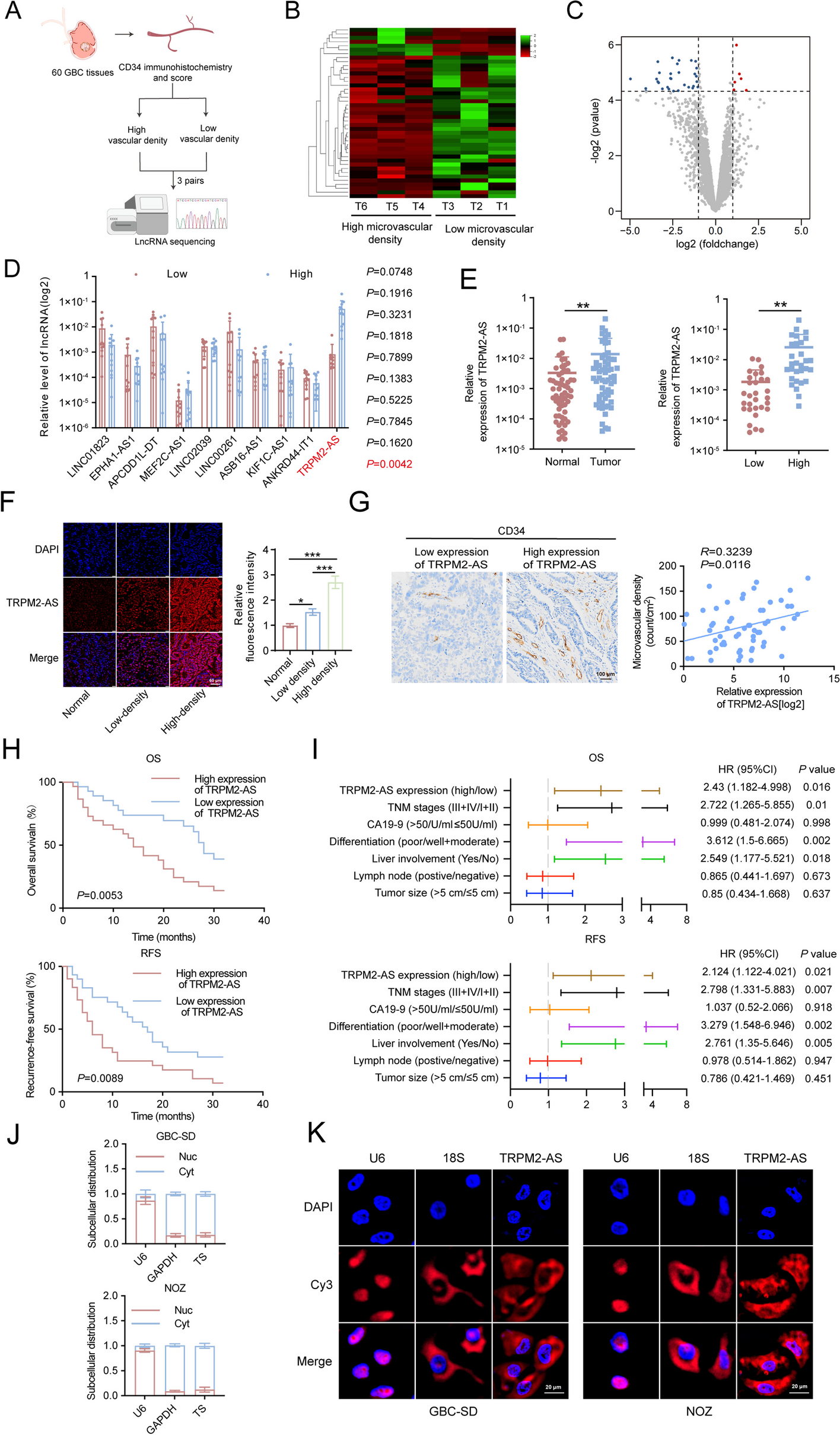 Exosomal long non-coding RNA TRPM2-AS promotes angiogenesis in gallbladder cancer through interacting with PABPC1 to activate NOTCH1 signaling pathway