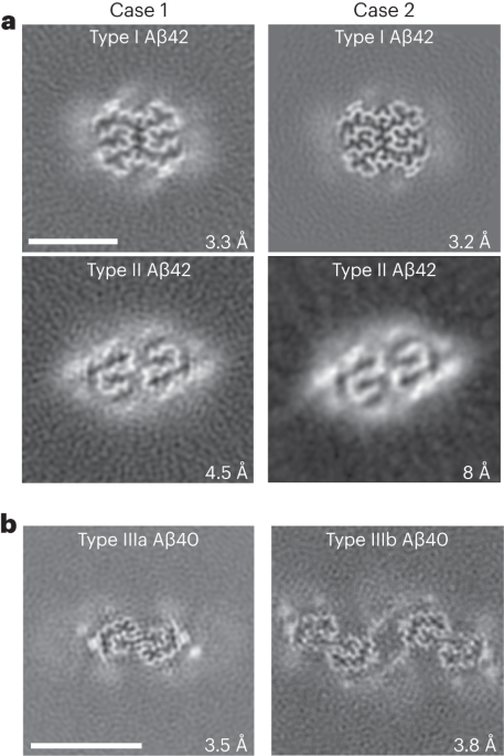 Cryo-EM structures of amyloid-β and tau filaments in Down syndrome