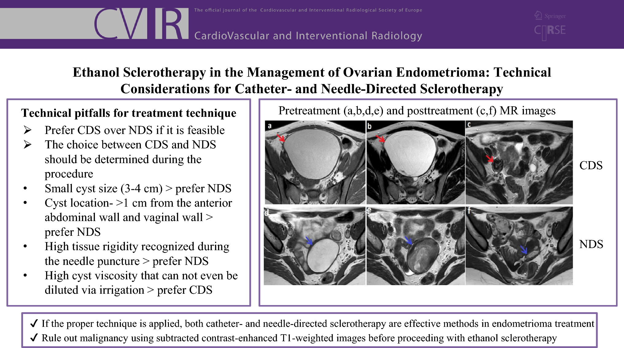Ethanol Sclerotherapy in the Management of Ovarian Endometrioma: Technical Considerations for Catheter- and Needle-Directed Sclerotherapy