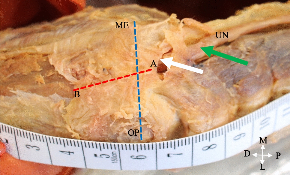 The anatomical variations of the cubital tunnel in a South African body donor sample