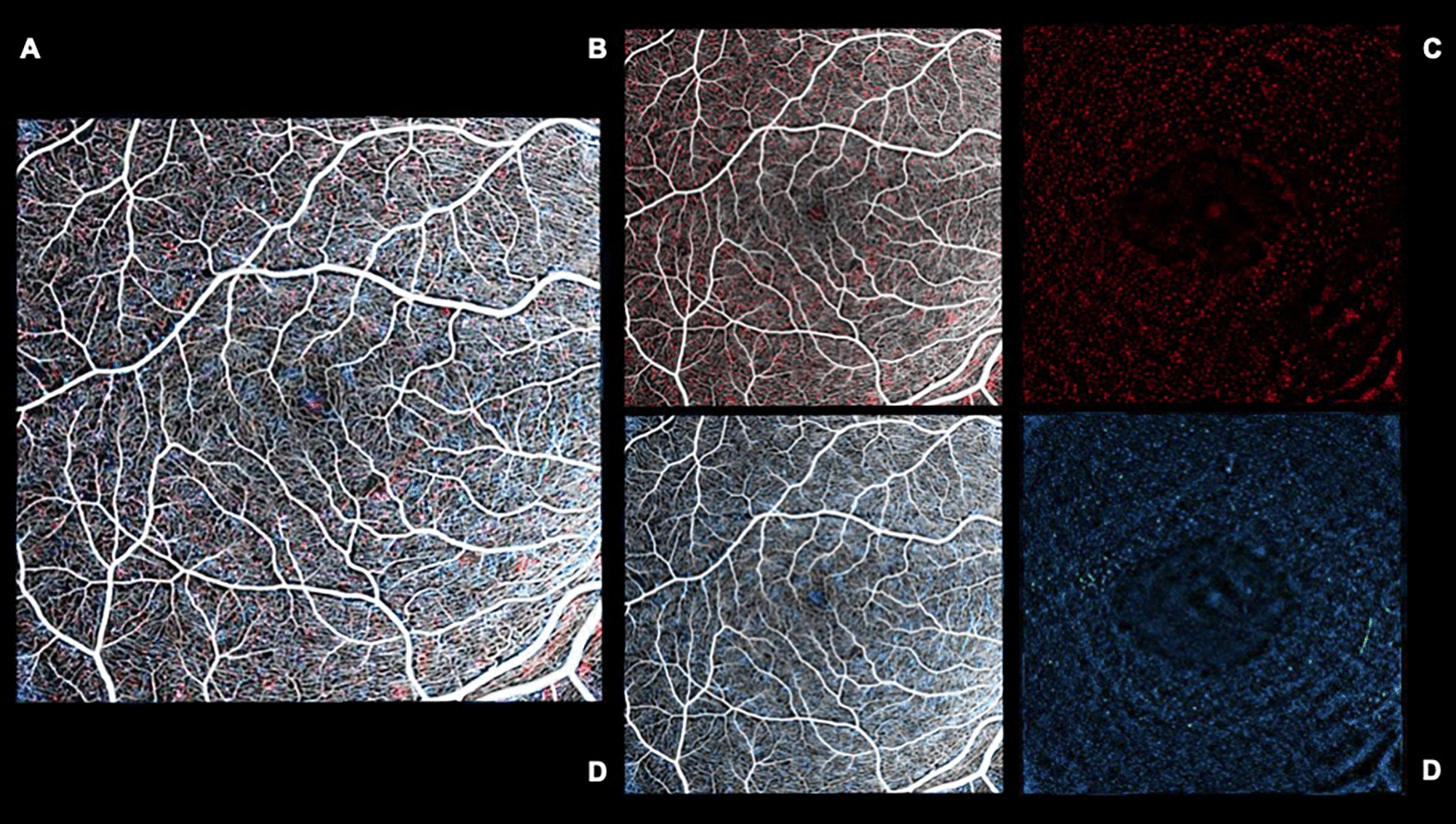 Dancing in the eye: dynamic optical coherence tomography to distinguish different retinal microglia populations