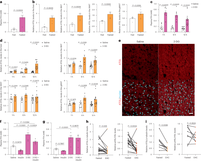 Glucose controls lipolysis through Golgi PtdIns4P-mediated regulation of ATGL