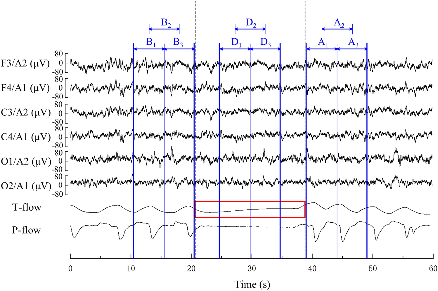 Altered Cortical Information Interaction During Respiratory Events in Children with Obstructive Sleep Apnea-Hypopnea Syndrome