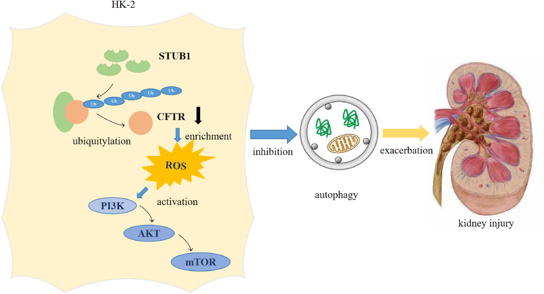 STUB1 exacerbates calcium oxalate-induced kidney injury by modulating reactive oxygen species-mediated cellular autophagy via regulating CFTR ubiquitination