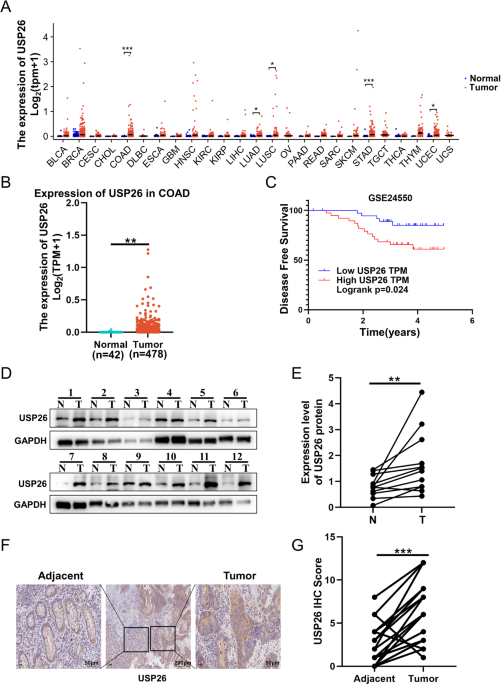 USP26 promotes colorectal cancer tumorigenesis by restraining PRKN-mediated mitophagy