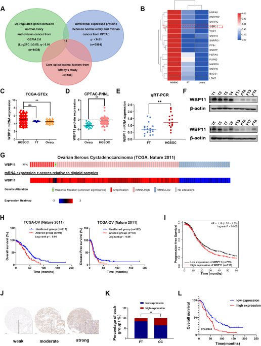 The splicing factor WBP11 mediates MCM7 intron retention to promote the malignant progression of ovarian cancer