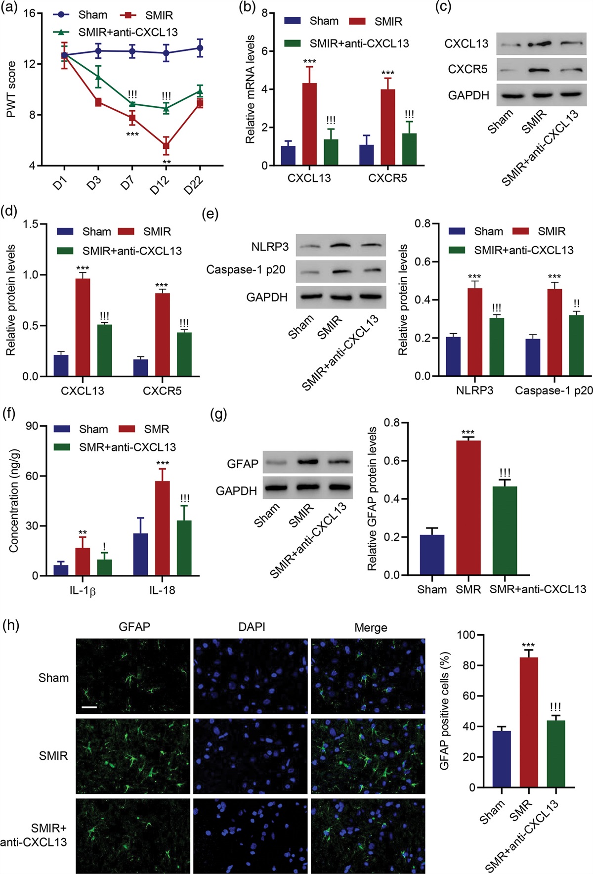 CXCL13/CXCR5 promote chronic postsurgical pain and astrocyte activation in rats by targeting NLRP3
