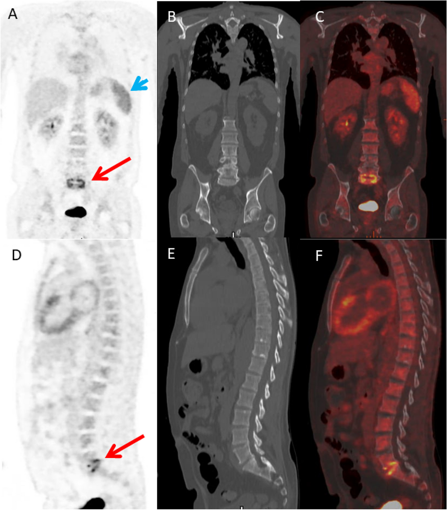 Molecular Imaging Techniques in the Diagnosis and Monitoring of Infectious Diseases