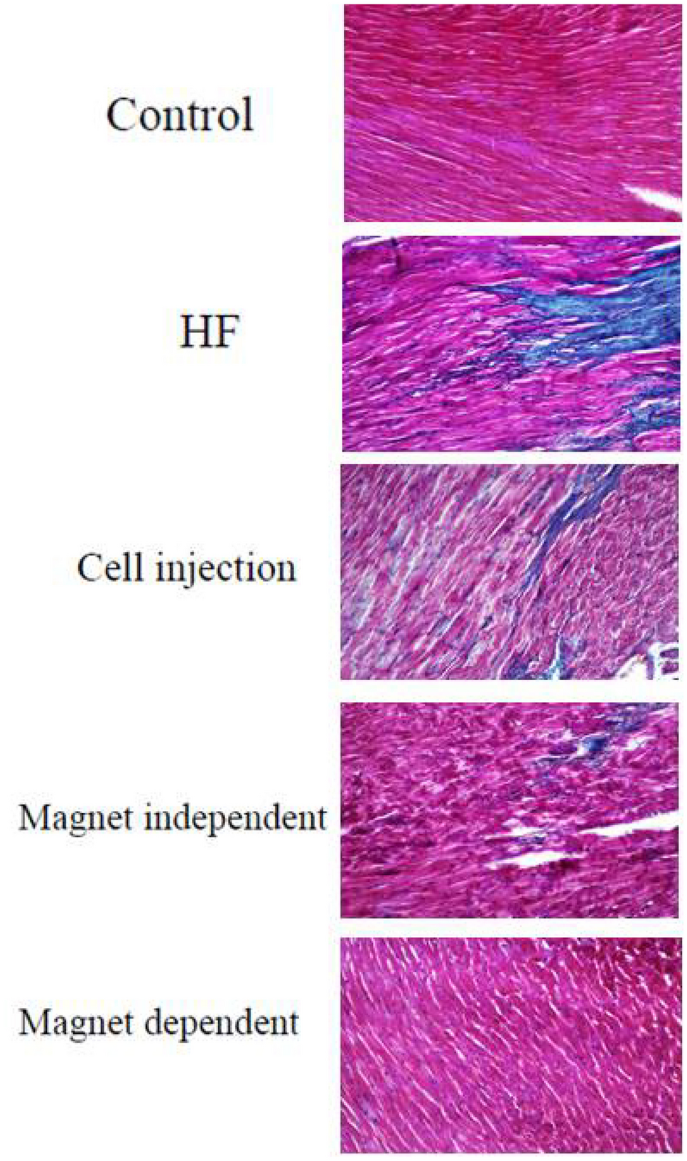 Correction to: The effects of superparamagnetic iron oxide nanoparticles-labeled mesenchymal stem cells in the presence of a magnetic field on attenuation of injury after heart failure