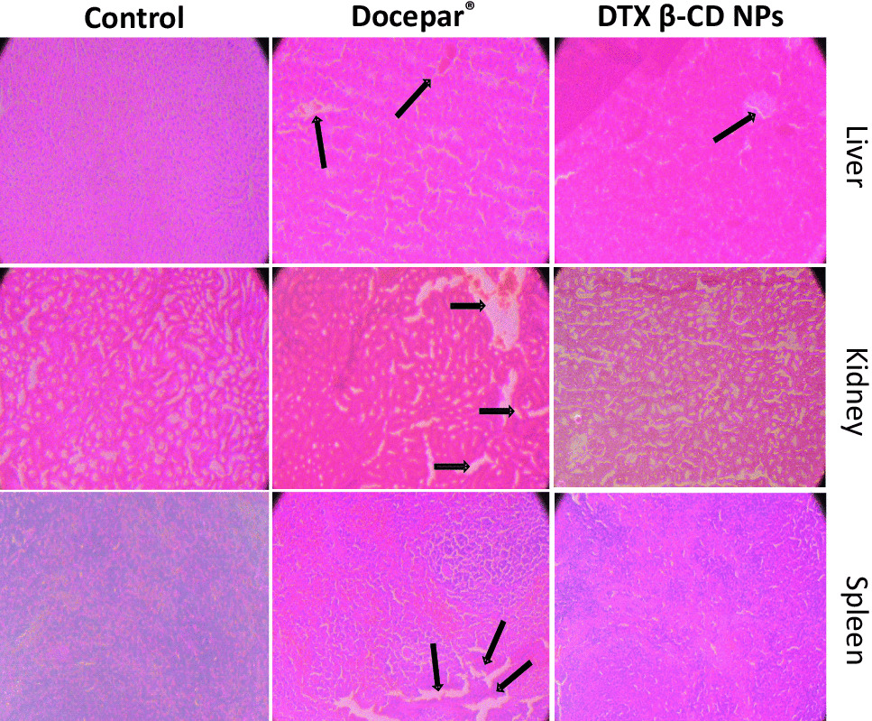 Correction: Partial inclusion complex assisted crosslinked β-cyclodextrin nanoparticles for improving therapeutic potential of docetaxel against breast cancer