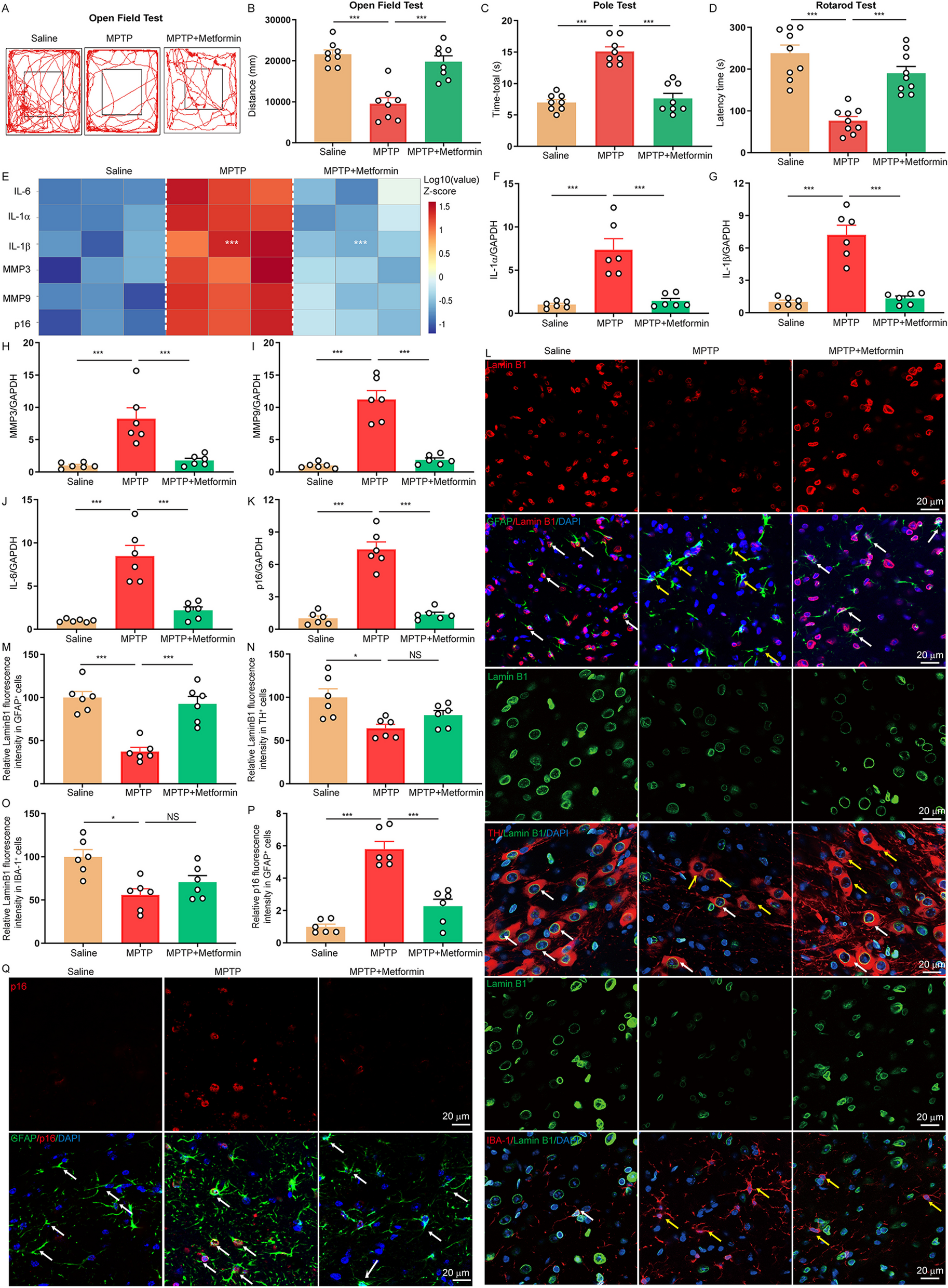 Metformin normalizes mitochondrial function to delay astrocyte senescence in a mouse model of Parkinson’s disease through Mfn2-cGAS signaling