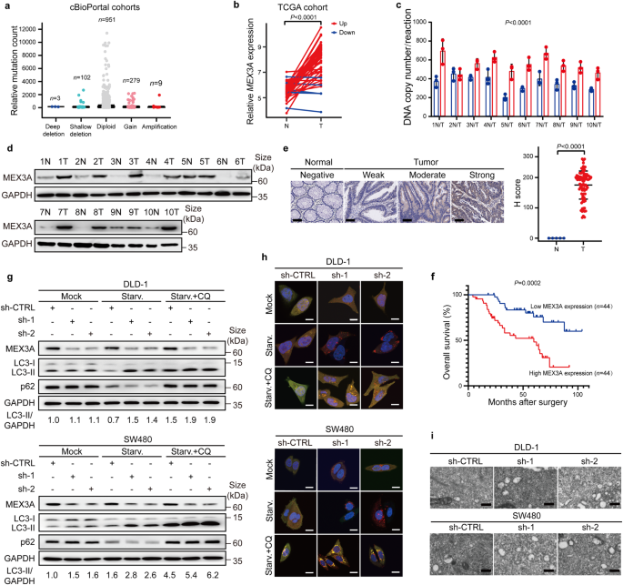 Mex-3 RNA binding family member A (MEX3A)/circMPP6 complex promotes colorectal cancer progression by inhibiting autophagy