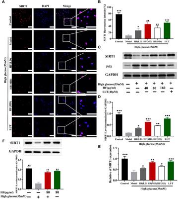 SIRT1/P53 in retinal pigment epithelial cells in diabetic retinopathy: a gene co-expression analysis and He-Ying-Qing-Re formula treatment