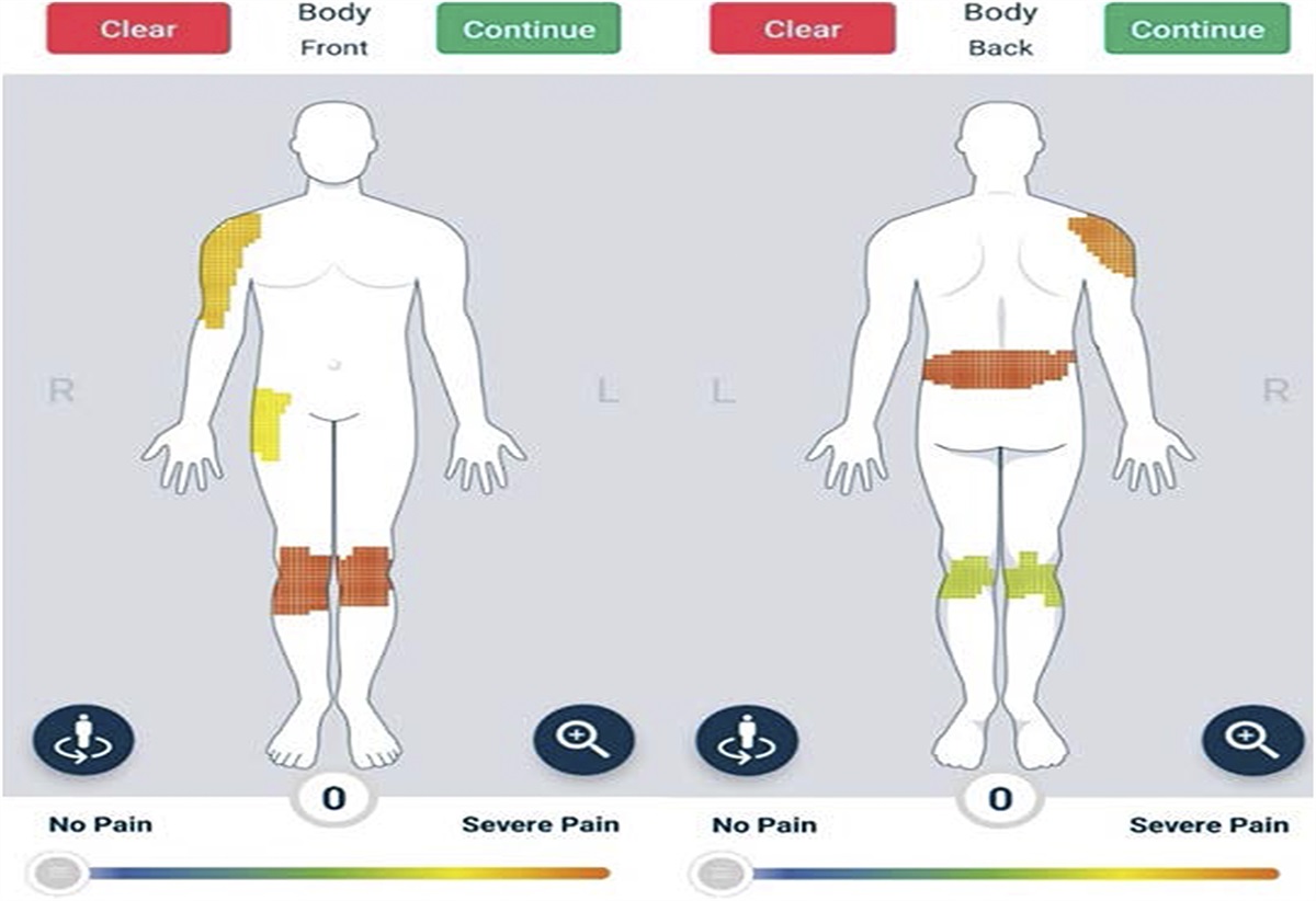 Reliability, validity, and responsiveness of a smartphone-based manikin to support pain self-reporting