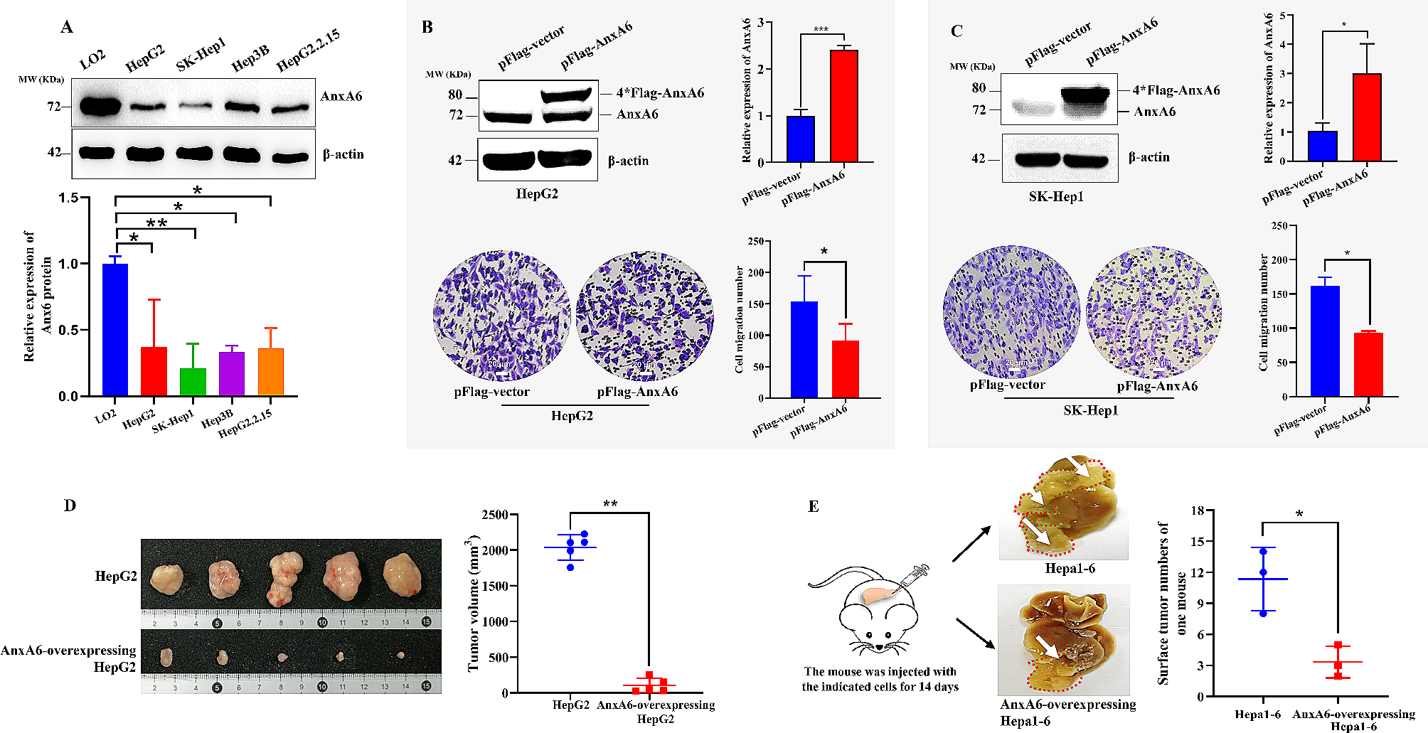 SUMOylation of annexin A6 retards cell migration and tumor growth by suppressing RHOU/AKT1–involved EMT in hepatocellular carcinoma