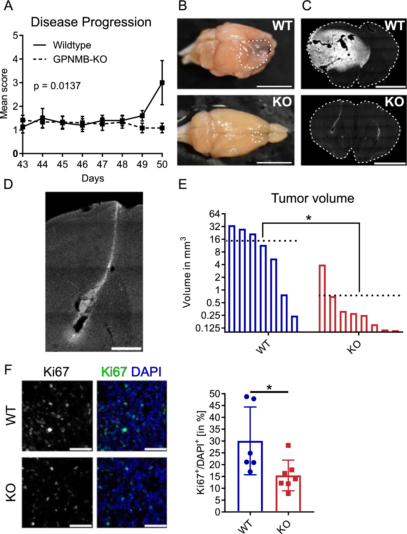 Tumor associated microglia/macrophages utilize GPNMB to promote tumor growth and alter immune cell infiltration in glioma
