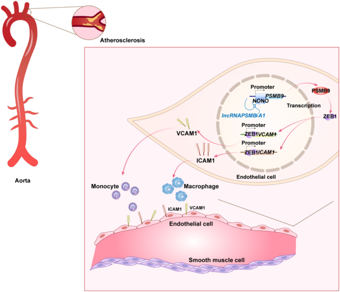 A novel role of PSMB9 in endothelial cells and atherosclerosis: beyond its canonical function in immunoproteasome