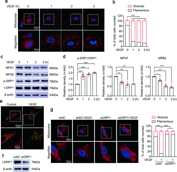 Decreasing mitochondrial fission ameliorates HIF-1α-dependent pathological retinal angiogenesis