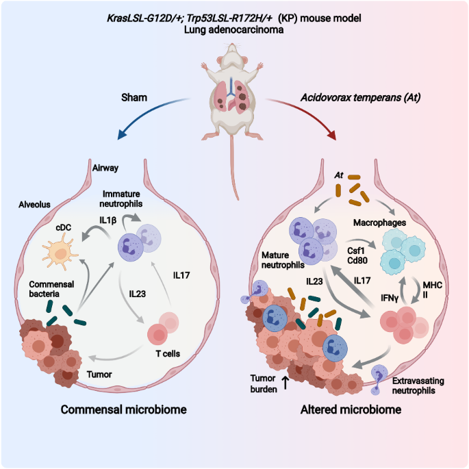 Acidovorax temperans skews neutrophil maturation and polarizes Th17 cells to promote lung adenocarcinoma development