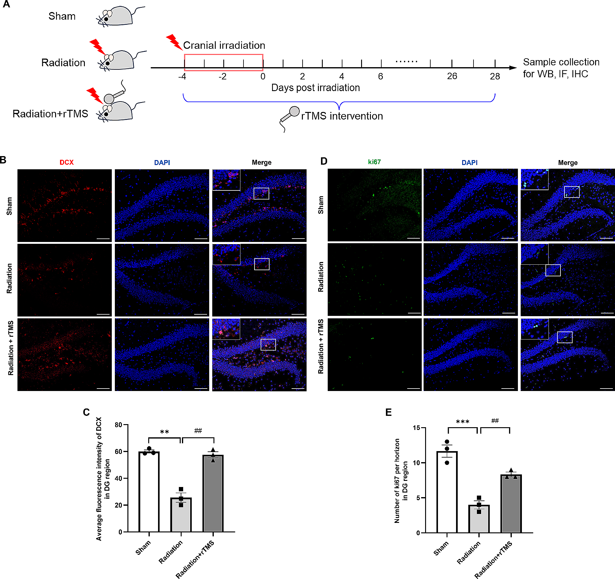 Repetitive transcranial magnetic stimulation ameliorates cognitive deficits in mice with radiation-induced brain injury by attenuating microglial pyroptosis and promoting neurogenesis via BDNF pathway