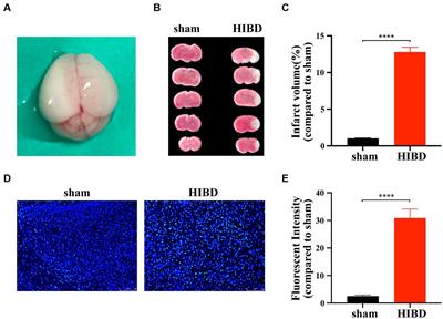 GluN2B-containing NMDA receptor attenuated neuronal apoptosis in the mouse model of HIBD through inhibiting endoplasmic reticulum stress-activated PERK/eIF2α signaling pathway